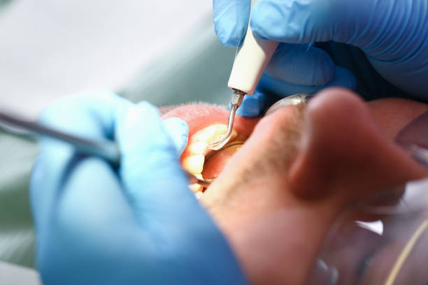 Best Cracked Tooth Emergency Dentist  in Whiskey Creek, FL